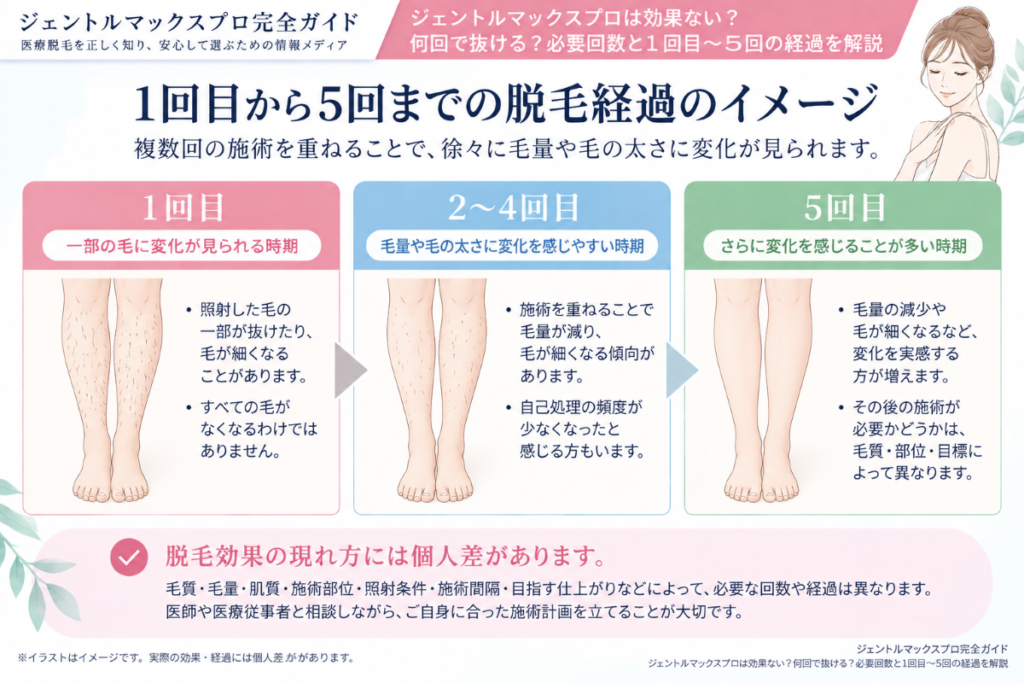 ジェントルマックスプロ1回目から5回までの脱毛経過の考え方
